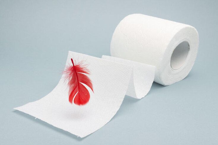 O sangue no papel hixiénico é un sinal de hemorroides